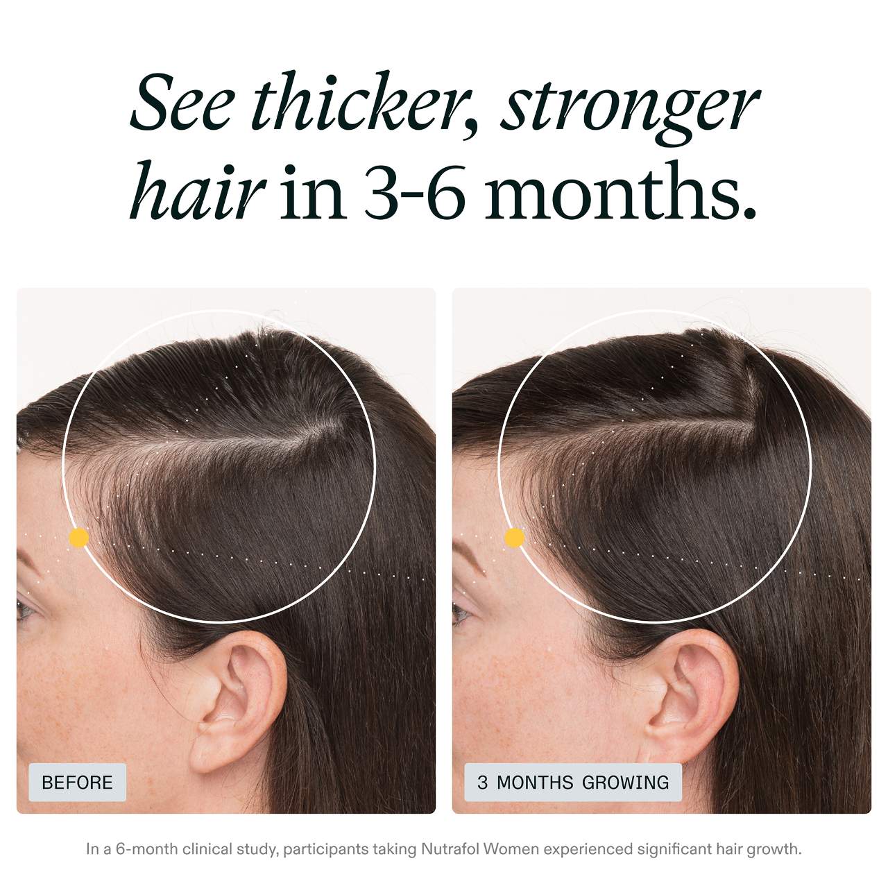 NUTRAFOL WOMEN Clinically Proven Hair Growth Supplement for Thinning preventa